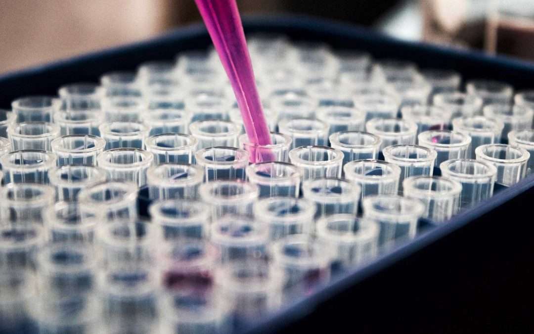 Les modifications des mitochondries du nerf optique dans l’AOD