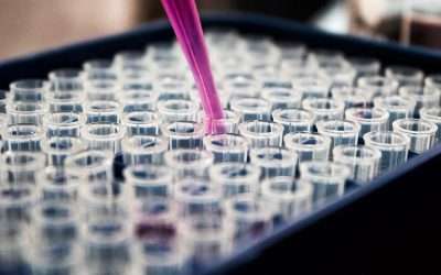 Les modifications des mitochondries du nerf optique dans l’AOD